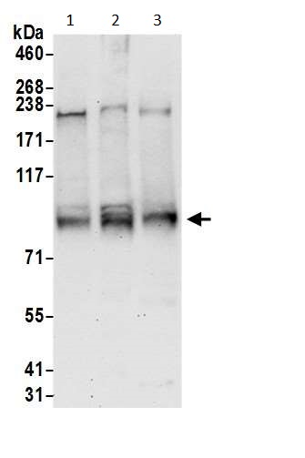 Western blot - Anti-SERCA2 ATPase antibody (AB3625)
