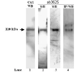 Western blot - Anti-SERCA2 ATPase antibody (AB3625)