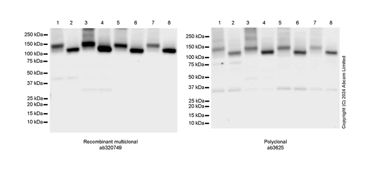 Western blot - Anti-SERCA2 ATPase antibody (AB3625)