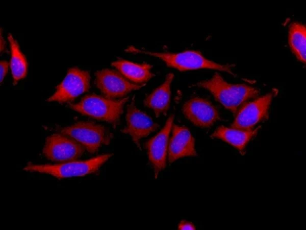 Immunocytochemistry/ Immunofluorescence - Anti-SERCA2 ATPase antibody [EPR9392] (AB150435)