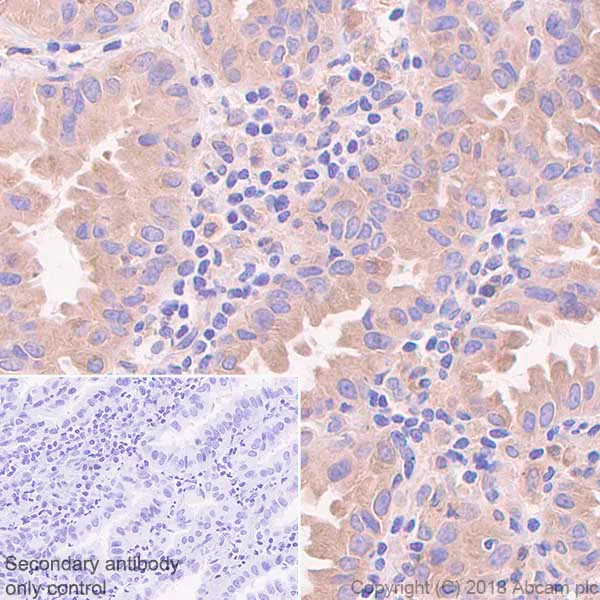 Immunohistochemistry (Formalin/PFA-fixed paraffin-embedded sections) - Anti-SERCA2 ATPase antibody [EPR9392] (AB150435)