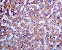 Immunohistochemistry (Formalin/PFA-fixed paraffin-embedded sections) - Anti-SERCA2 ATPase antibody [EPR9392] (AB150435)
