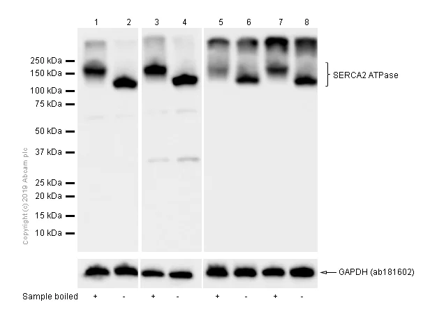 Western blot - Anti-SERCA2 ATPase antibody [EPR9392] (AB150435)