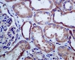 Immunohistochemistry (Formalin/PFA-fixed paraffin-embedded sections) - Anti-SERCA2 ATPase antibody [EPR9392] - BSA and Azide free (AB238426)