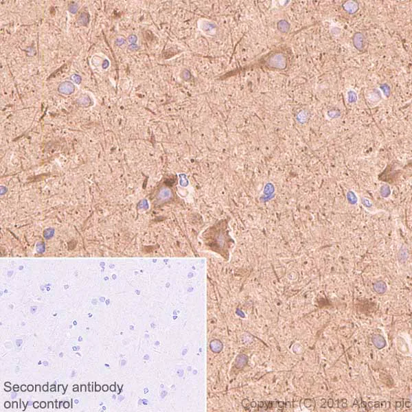 Immunohistochemistry (Formalin/PFA-fixed paraffin-embedded sections) - Anti-SERCA2 ATPase antibody [EPR9392] - BSA and Azide free (AB238426)