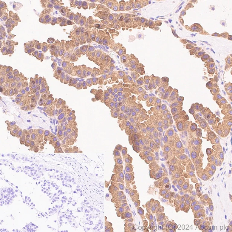 Immunohistochemistry (Formalin/PFA-fixed paraffin-embedded sections) - Anti-SERCA2 ATPase antibody [EPR9393] - BSA and Azide free (AB240095)