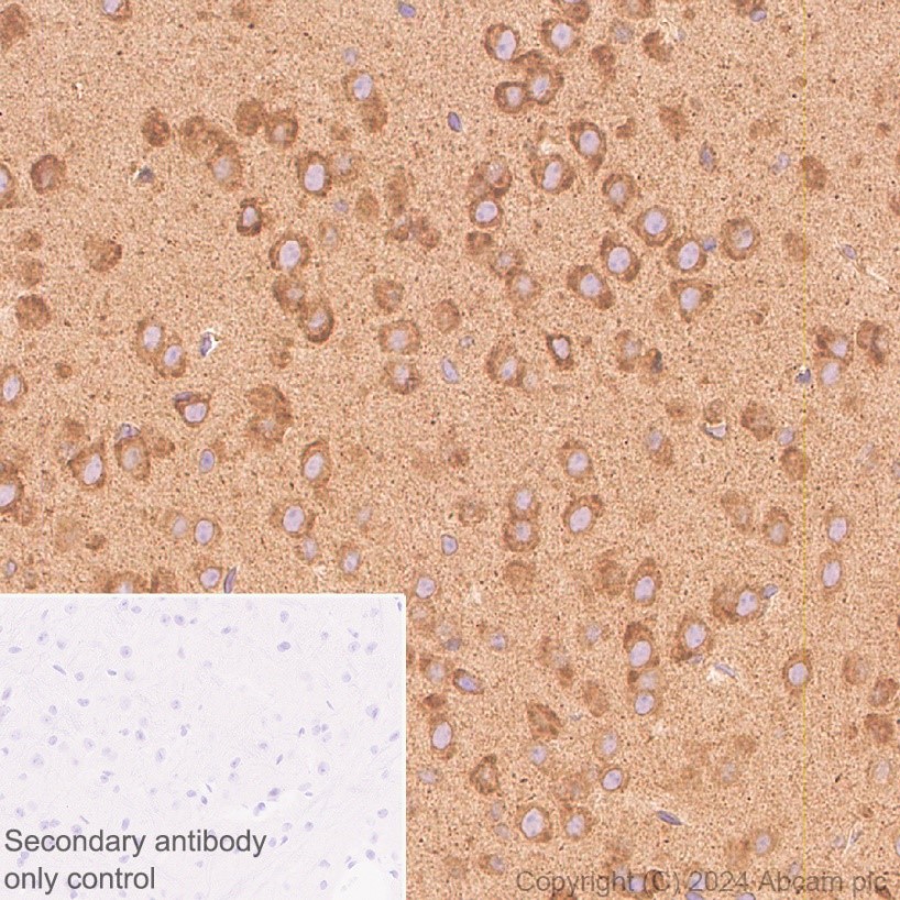 Immunohistochemistry (Formalin/PFA-fixed paraffin-embedded sections) - Anti-SERCA2 ATPase antibody [EPR9393] - BSA and Azide free (AB240095), expandable thumbnail