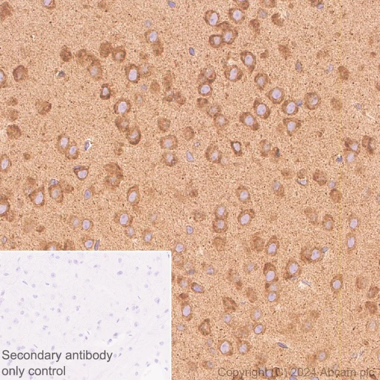 Immunohistochemistry (Formalin/PFA-fixed paraffin-embedded sections) - Anti-SERCA2 ATPase antibody [EPR9393] - BSA and Azide free (AB240095)