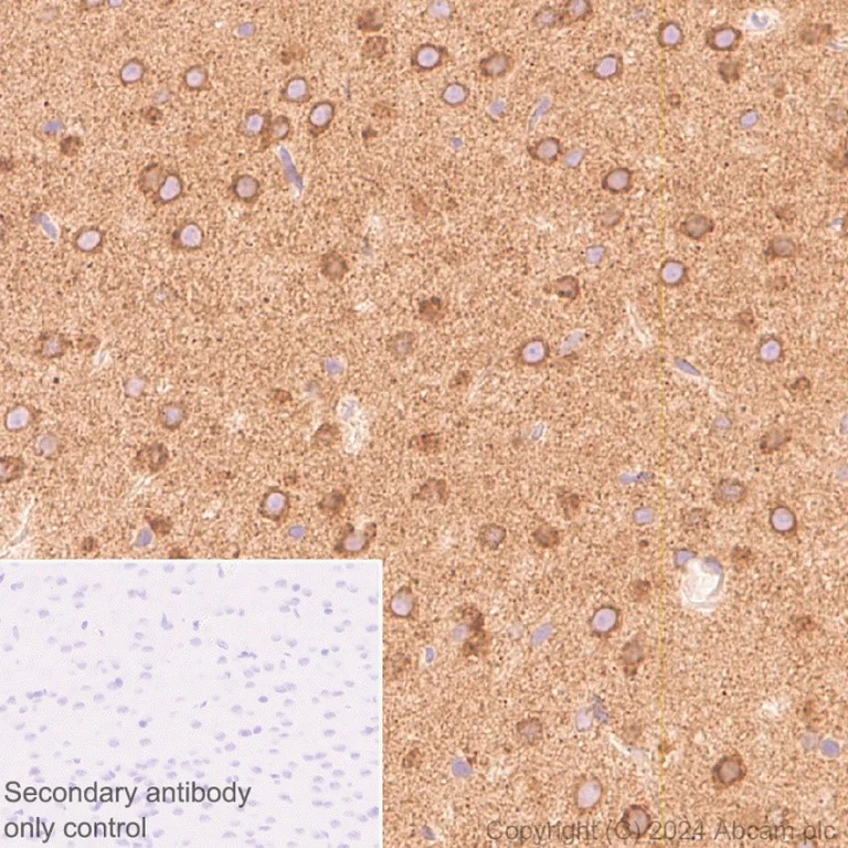 Immunohistochemistry (Formalin/PFA-fixed paraffin-embedded sections) - Anti-SERCA2 ATPase antibody [EPR9393] - BSA and Azide free (AB240095)