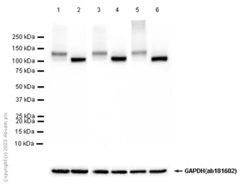 Western blot - Anti-SERCA2 ATPase antibody [EPR9393] - BSA and Azide free (AB240095)
