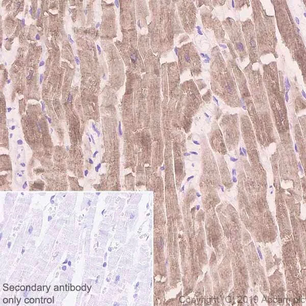 Immunohistochemistry (Formalin/PFA-fixed paraffin-embedded sections) - Anti-SERCA2 ATPase antibody [IID8] (AB2817)