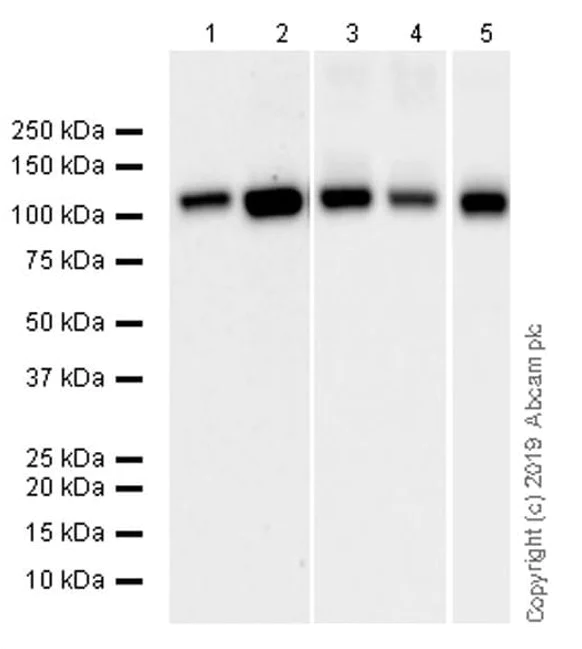 Western blot - Anti-SERCA2 ATPase antibody [IID8] (AB2817)