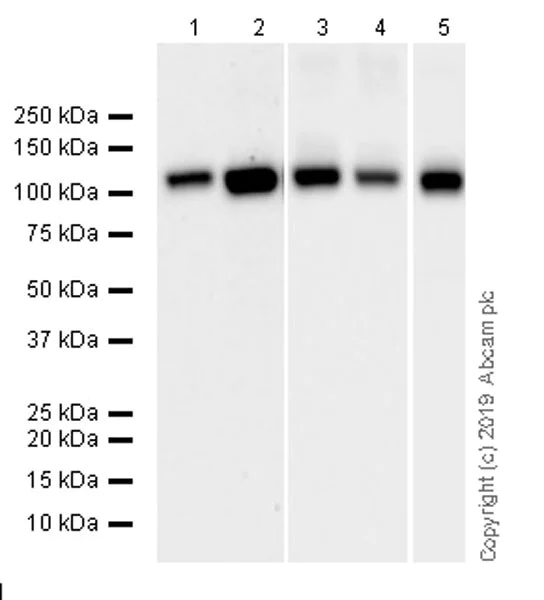 Western blot - Anti-SERCA2 ATPase antibody [IID8] - BSA and Azide free (AB255960)