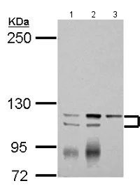 Western blot - Anti-SERCA3 ATPase antibody - N-terminal (AB154259)