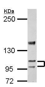 Western blot - Anti-SERCA3 ATPase antibody - N-terminal (AB154259)