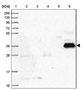 Western blot - Anti-SERINC5 antibody (AB204400)