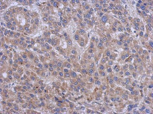 Immunohistochemistry (Formalin/PFA-fixed paraffin-embedded sections) - Anti-Serine Palmitoyltransferase antibody (AB229330)