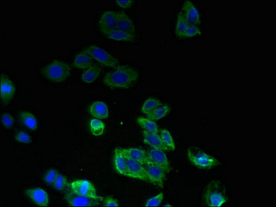 Immunocytochemistry/ Immunofluorescence - Anti-Serine Palmitoyltransferase antibody (AB236900), expandable thumbnail
