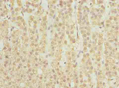 Immunohistochemistry (Formalin/PFA-fixed paraffin-embedded sections) - Anti-Serine Palmitoyltransferase antibody (AB236900), expandable thumbnail