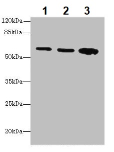 Western blot - Anti-Serine Palmitoyltransferase antibody (AB236900), expandable thumbnail