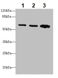 Western blot - Anti-Serine Palmitoyltransferase antibody (AB236900)