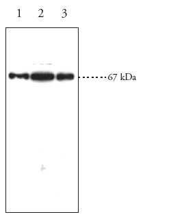 Western blot - Anti-Serine Palmitoyltransferase antibody (AB23696)
