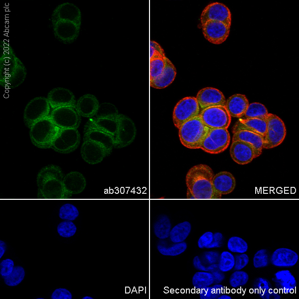 Immunocytochemistry/ Immunofluorescence - Anti-Serine Palmitoyltransferase antibody [EPR26954-39] - BSA and Azide free (AB307433), expandable thumbnail