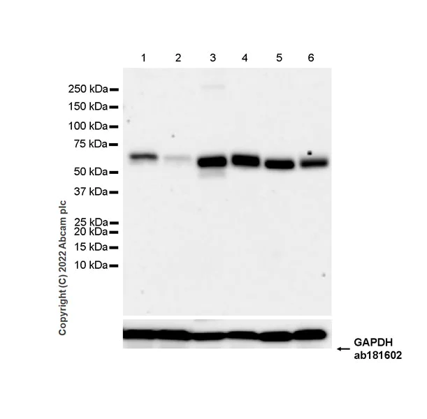 Western blot - Anti-Serine Palmitoyltransferase antibody [EPR26954-39] - BSA and Azide free (AB307433)
