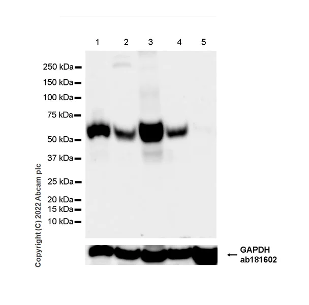 Western blot - Anti-Serine Palmitoyltransferase antibody [EPR26954-39] - BSA and Azide free (AB307433)