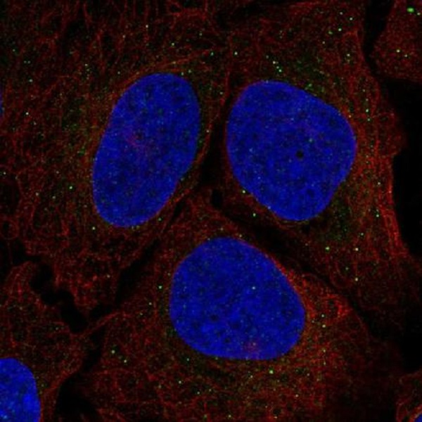 Immunocytochemistry/ Immunofluorescence - Anti-Serine racemase antibody (AB219855)