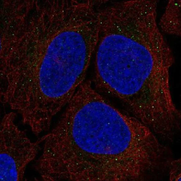 Immunocytochemistry/ Immunofluorescence - Anti-Serine racemase antibody (AB219855)