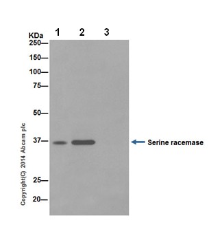 Immunoprecipitation - Anti-Serine racemase antibody [EPR16682] (AB200833), expandable thumbnail