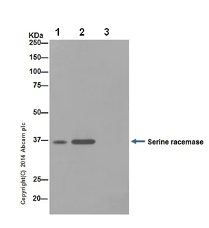 Immunoprecipitation - Anti-Serine racemase antibody [EPR16682] (AB200833)