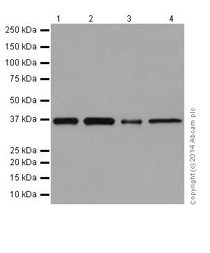 Western blot - Anti-Serine racemase antibody [EPR16682] (AB200833), expandable thumbnail