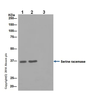 Immunoprecipitation - Anti-Serine racemase antibody [EPR16682] - BSA and Azide free (AB251323)