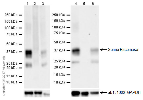 Western blot - Anti-Serine racemase antibody [EPR18747] - BSA and Azide free (AB250608), expandable thumbnail
