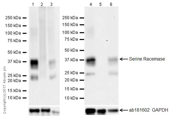Western blot - Anti-Serine racemase antibody [EPR18747] - BSA and Azide free (AB250608)