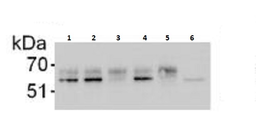 Immunoprecipitation - Anti-Serine/threonine-protein kinase 4/MST-1 antibody (AB264127)