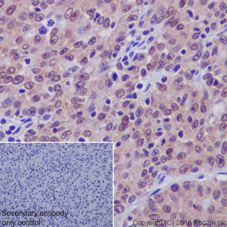 Immunohistochemistry (Formalin/PFA-fixed paraffin-embedded sections) - Anti-Serine/threonine-protein kinase 4/MST-1 antibody [EP1465Y] (AB51134)
