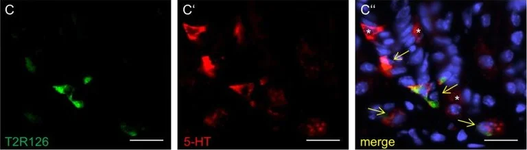 Immunohistochemistry (Frozen sections) - Anti-Serotonin antibody (AB66047)