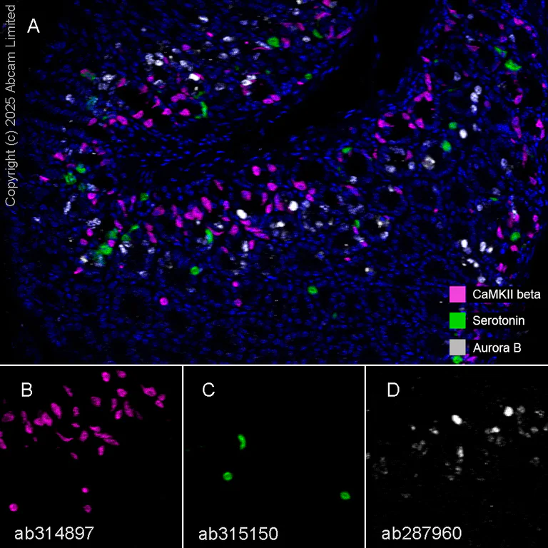 Multiplex immunohistochemistry - Anti-Serotonin antibody [EPR24431-201] (AB315150)