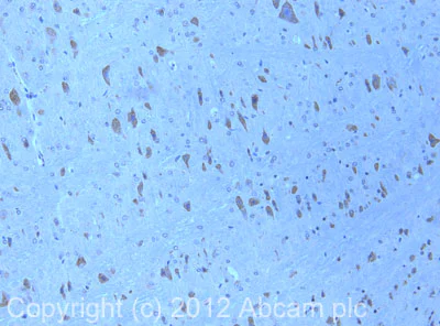 Anti-Serotonin antibody [YC5/45] (ab6336) | Abcam