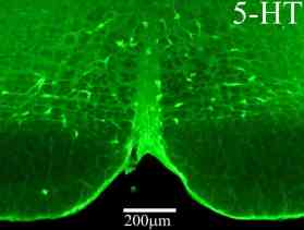 Anti-Serotonin antibody [YC5/45] (ab6336) | Abcam