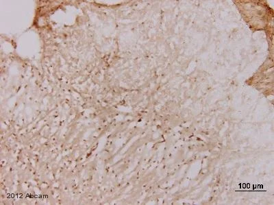 Anti-Serotonin antibody [YC5/45] (ab6336) | Abcam