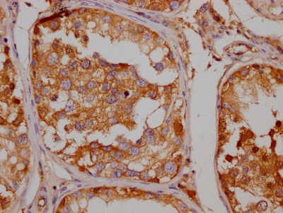 Immunohistochemistry (Formalin/PFA-fixed paraffin-embedded sections) - Anti-Serotonin transporter antibody [9G3] (AB314016), expandable thumbnail
