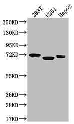 Western blot - Anti-Serotonin transporter antibody [9G3] (AB314016), expandable thumbnail