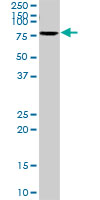 Western blot - Anti-Serotonin transporter antibody (AB102048), expandable thumbnail