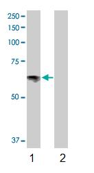 Western blot - Anti-Serotonin transporter antibody (AB102048), expandable thumbnail