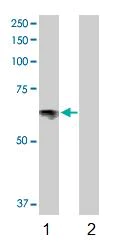Western blot - Anti-Serotonin transporter antibody (AB102048)