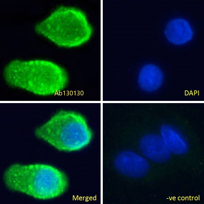 Immunocytochemistry - Anti-Serotonin transporter antibody (AB130130)